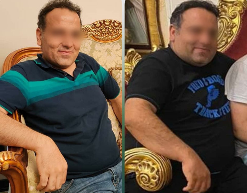 عمل بای پس معده